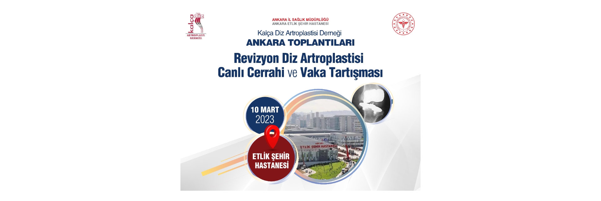 Revizyon Diz Artroplastisi Canlı Cerrahi Ve Vaka Tartışması Toplantısı